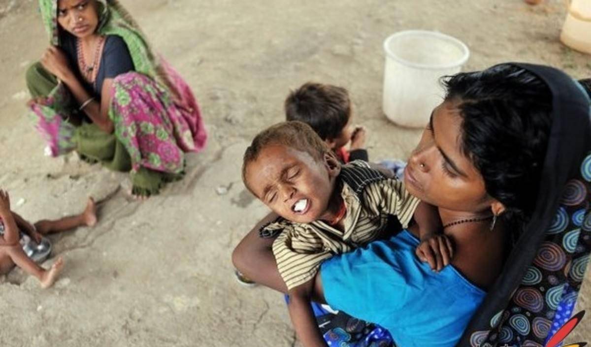 印度饥饿儿童图片