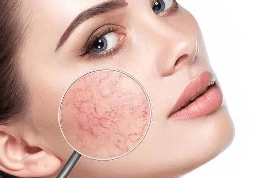 清滋颜:皮肤瘙痒,起疹子,红肿……是敏感肌还是干燥?怎么避免?