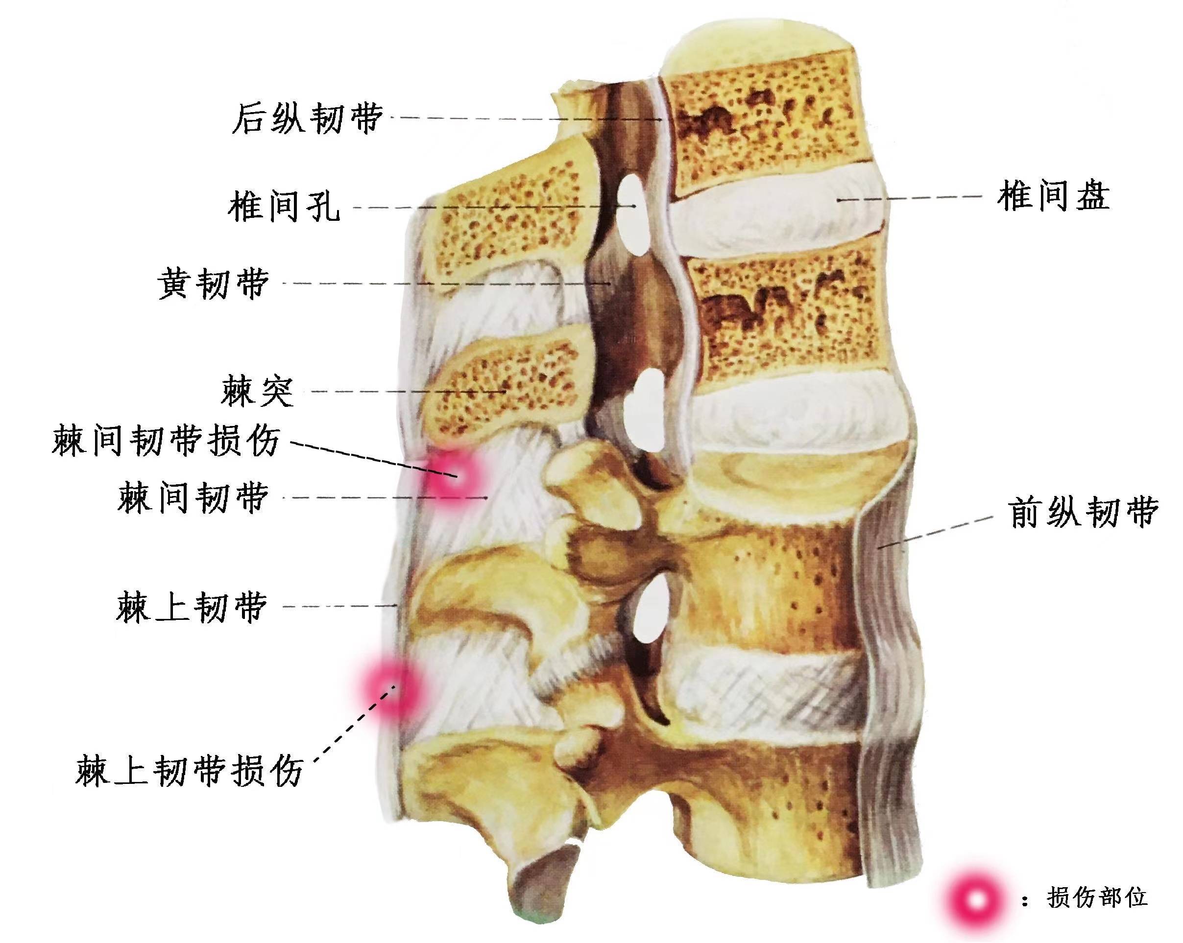 腰痛?你要注意这几点