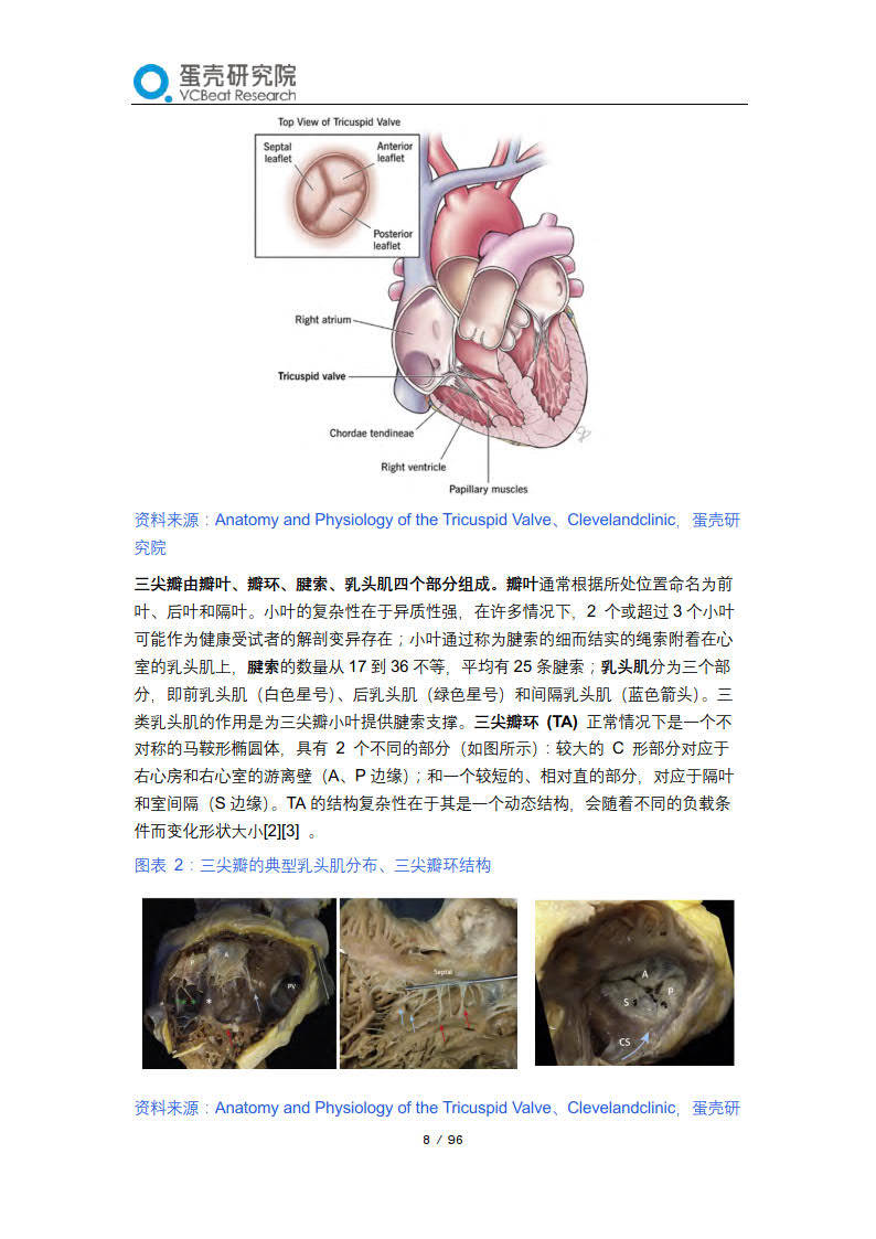 2023经导管三尖瓣介入治疗行业报告—三尖瓣不再被遗忘,中国创新闪耀