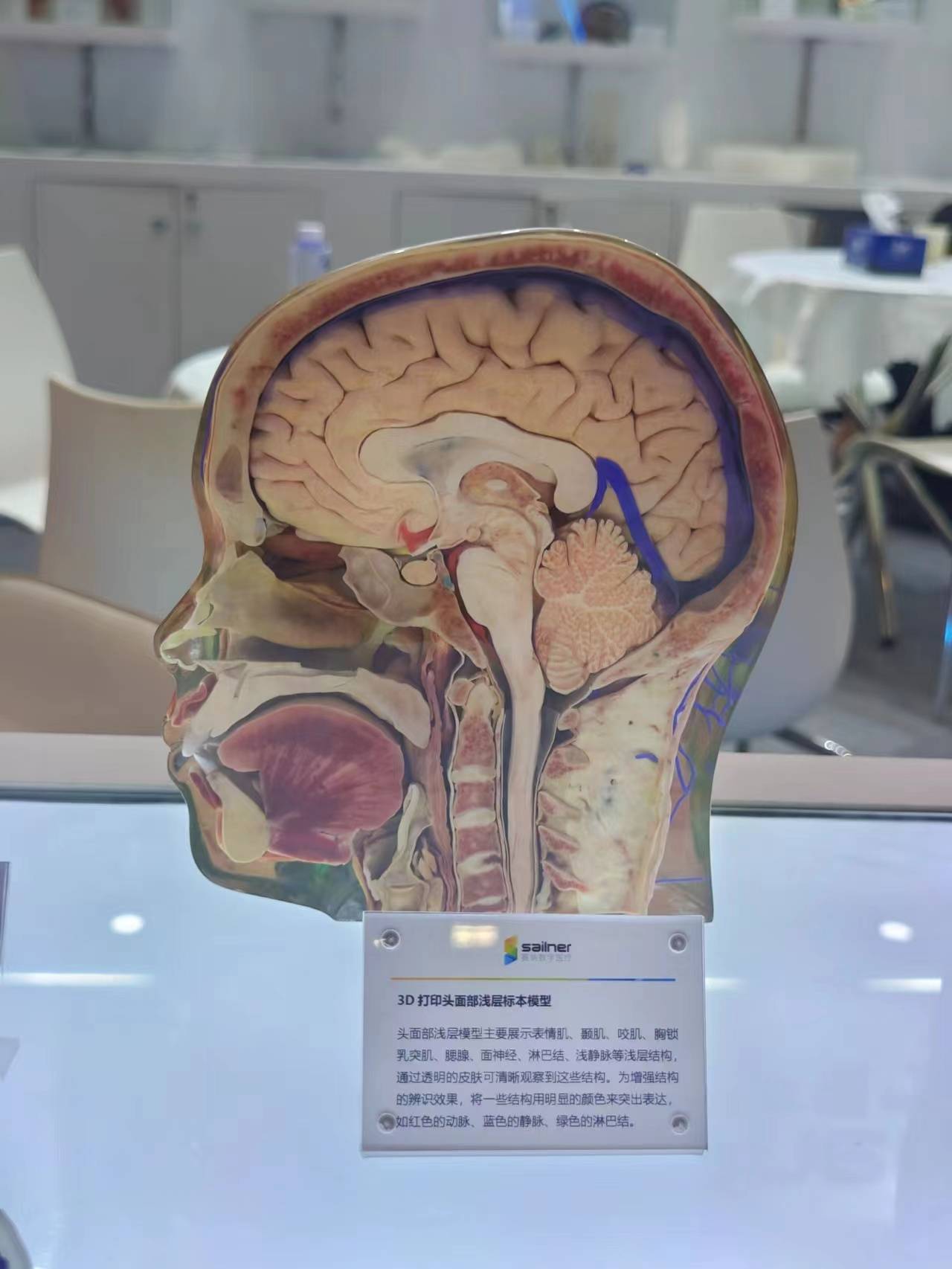 标本模型赛纳数字医疗3d打印手部模型赛纳数字医疗3d打印肺分段模型