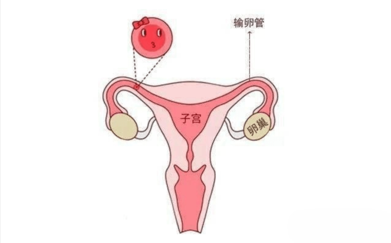 输卵管卡通图片