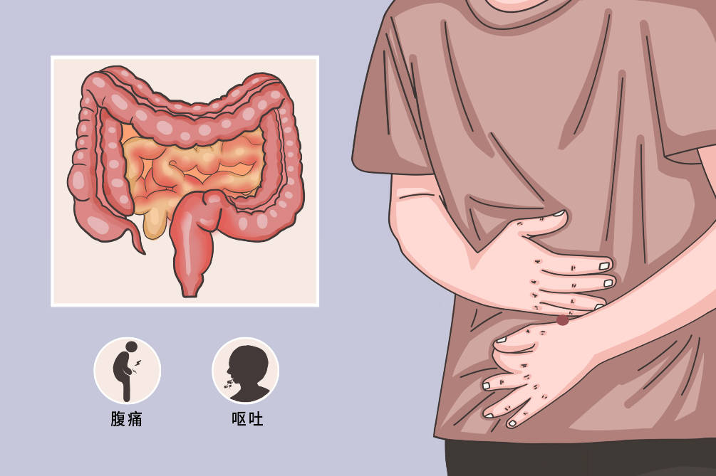 胃肠疾病-这样才会减少胃酸,赶紧让胃好起来