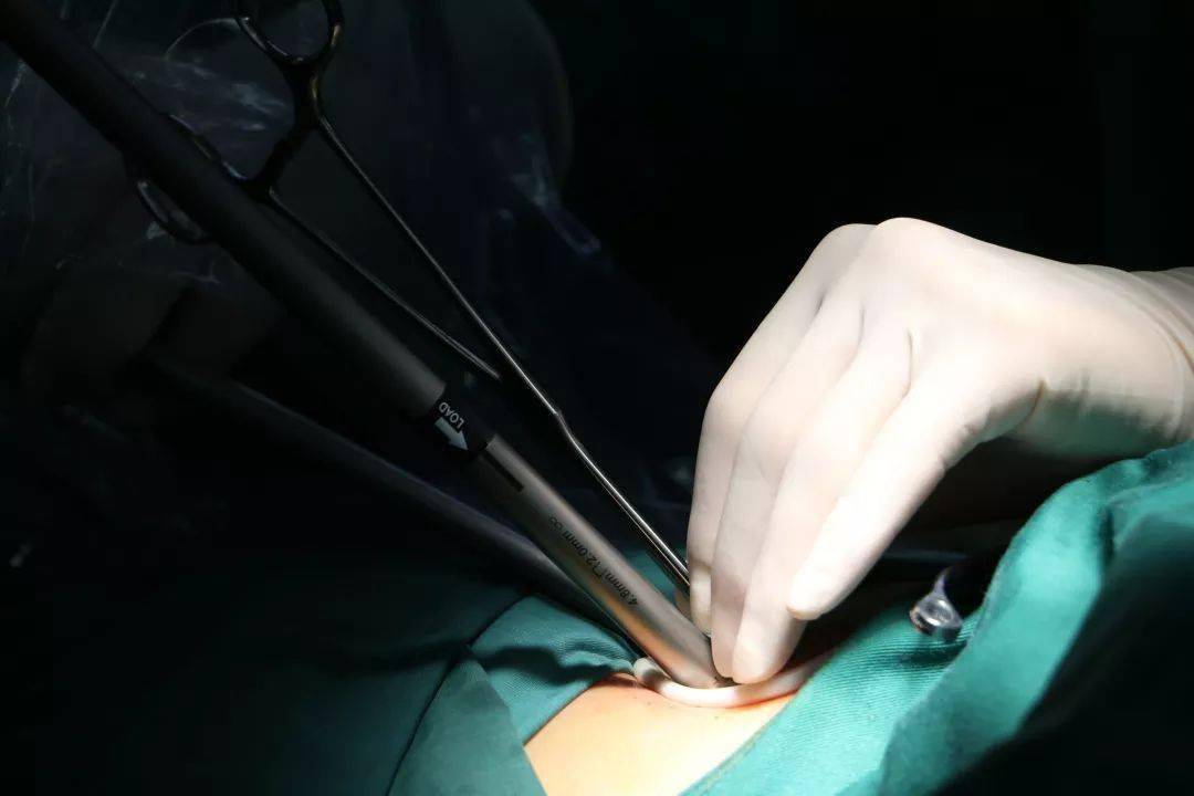 洪泉头条直击忙碌的扬州洪泉医院周六手术室