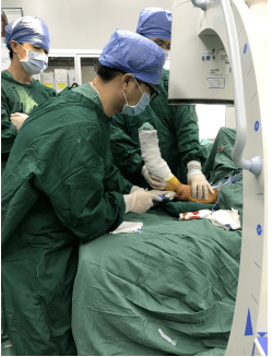 【技术分享】晋南分院骨科开展微创新技术——弹性髓内钉