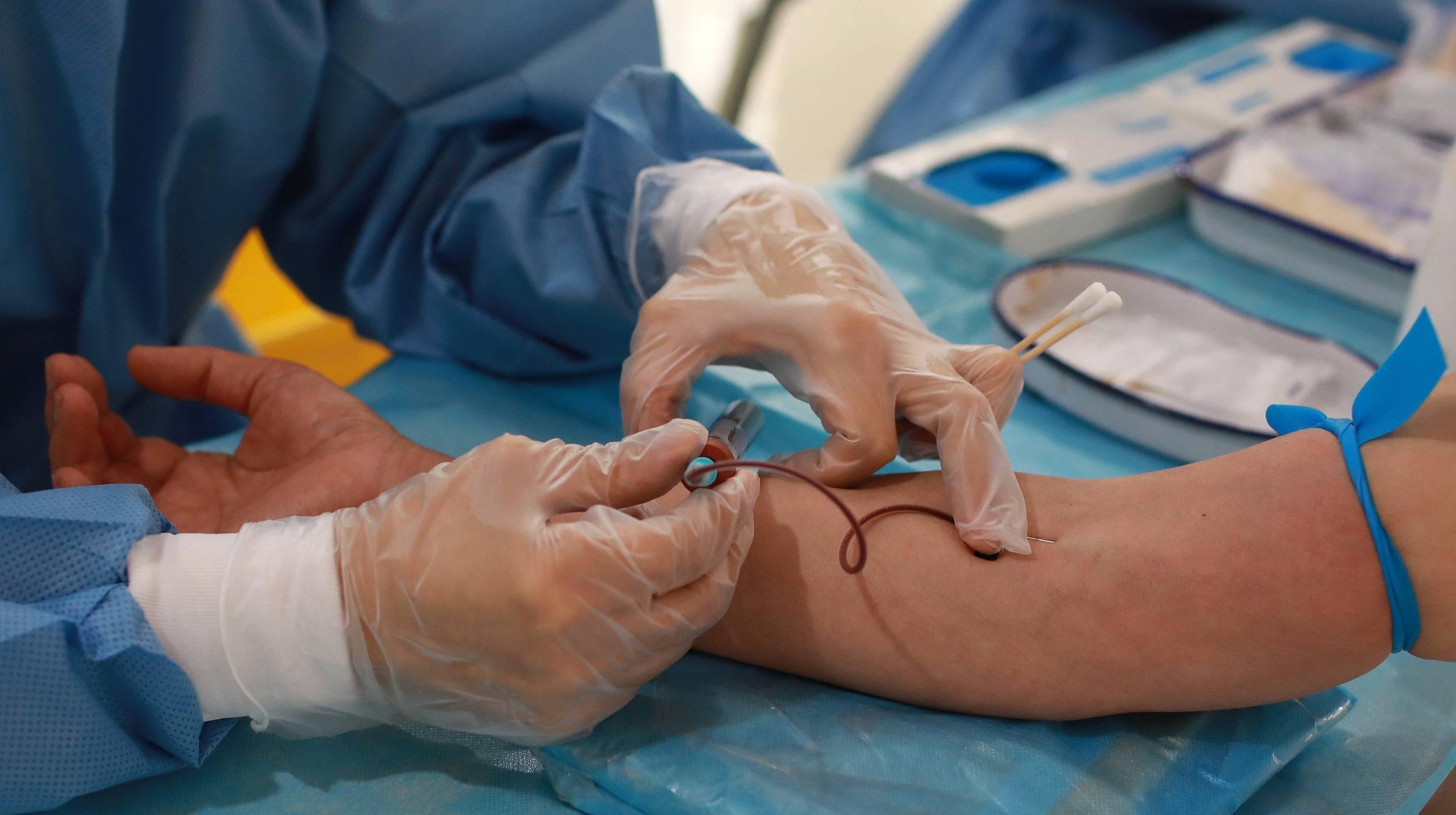 全球最快疫苗临床试药博士头疼乏力关节痛我却没慌