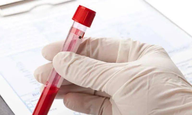 溶血标本对检验结果的影响的原因分析及注意事项