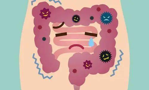 女儿确诊早期结肠癌医生劝其带家人做肠镜发现母亲竟然也是结直肠癌