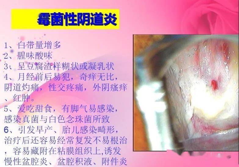 關注女性生殖健康幸福健康帶給你4