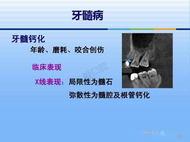 牙体牙周正常解剖及常见病x线表现