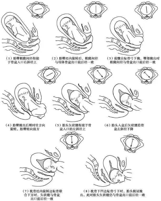 胎儿粗隆间径示意图图片