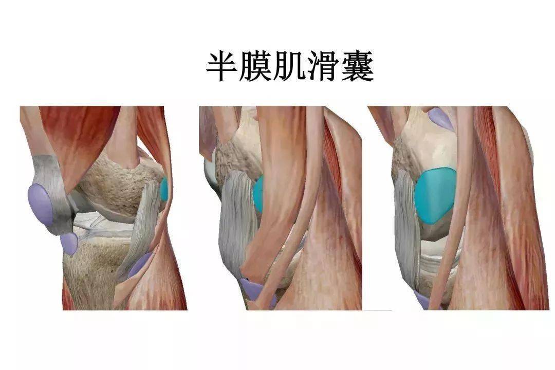 膝关节3d解剖图图片