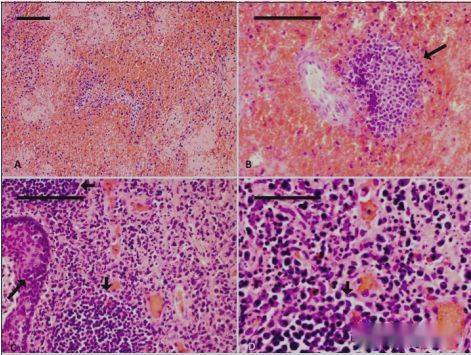 脾脏红髓和白髓大面积出血,坏死,淋巴细胞减少; b.