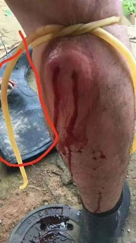 天越热危险越近,又有钓友毒发身亡_路亚