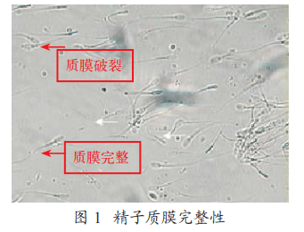 高尔基体顶体图片