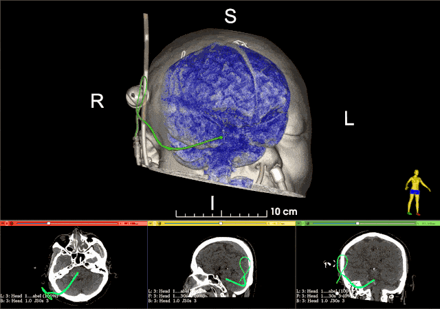 640_450gif 动态图 动图