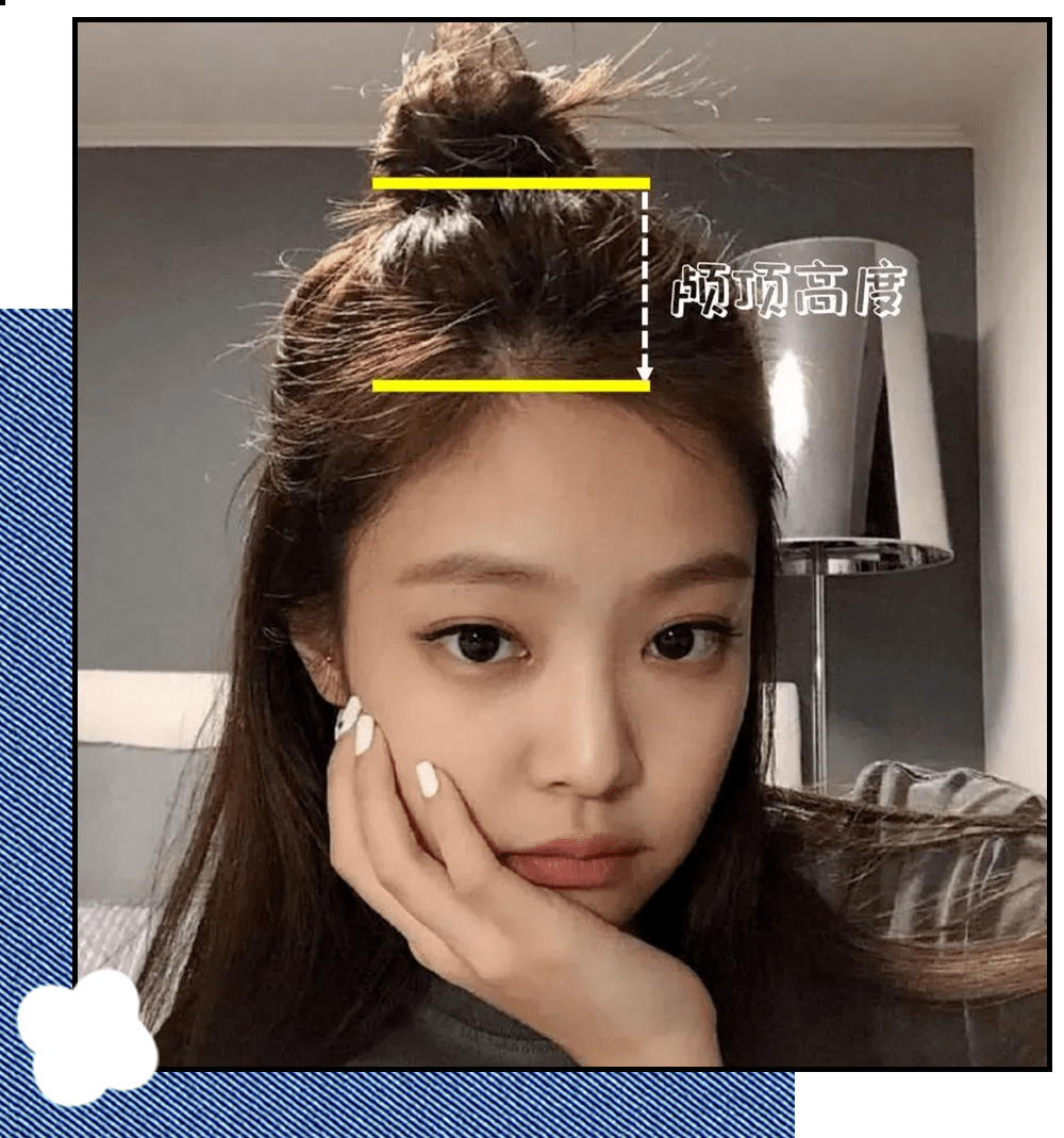 发际线最高处到头顶最高处的垂直距离,高颅顶会产生" 头包脸"的感觉