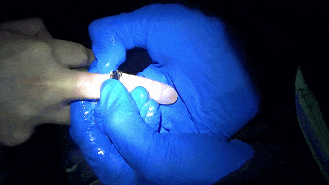 戒指咬手频频发生到底是什么原因喜欢戴戒指的小伙伴们请看过来