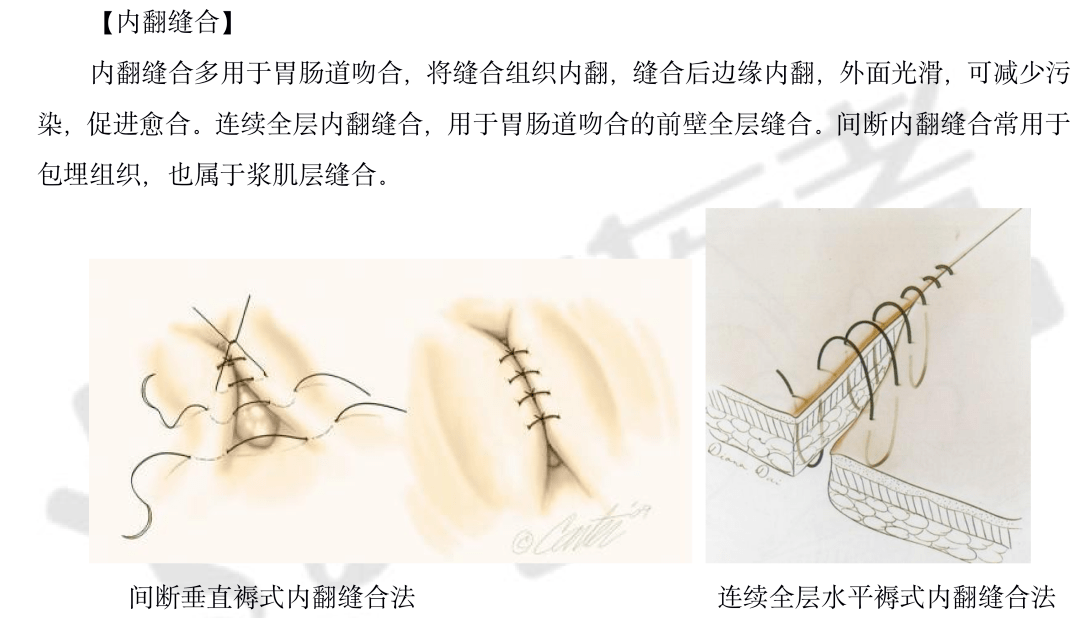 教你4步拆解病例分析题,用万能公式轻松得分