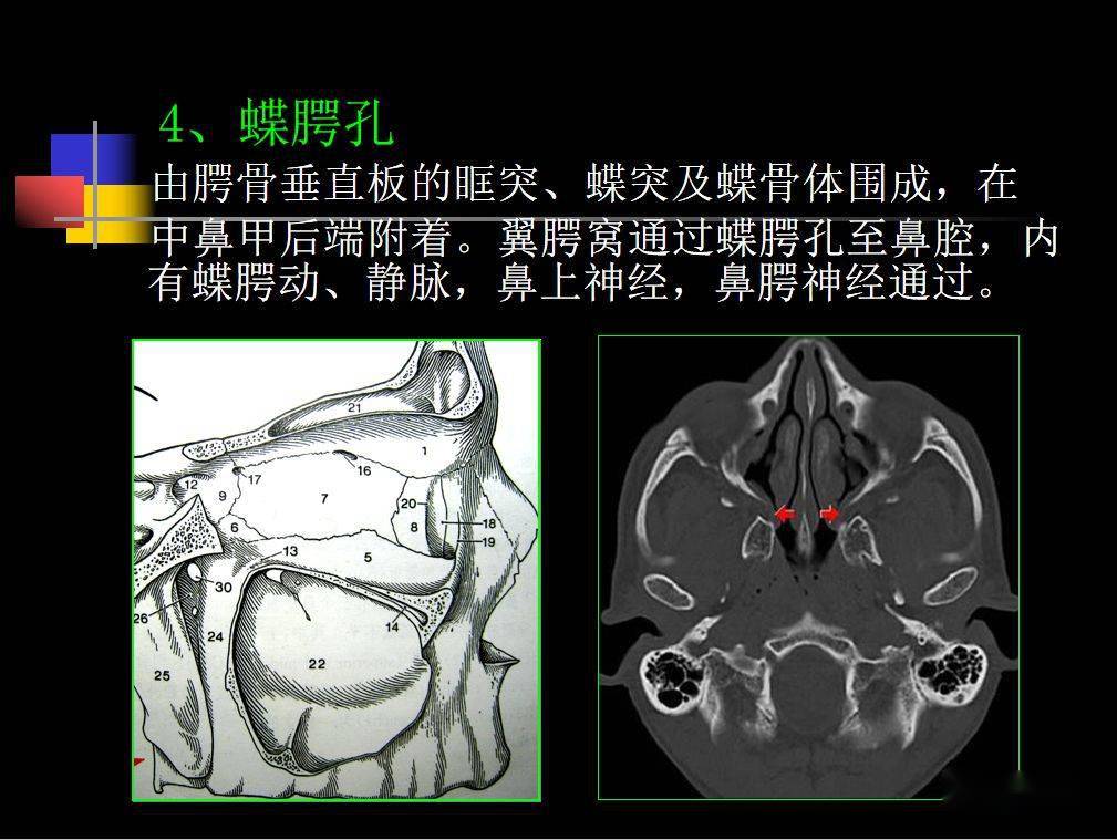 鼻咽部為呼吸道的起始部位,其內結構複雜,除了軟組織結構外,還包含了