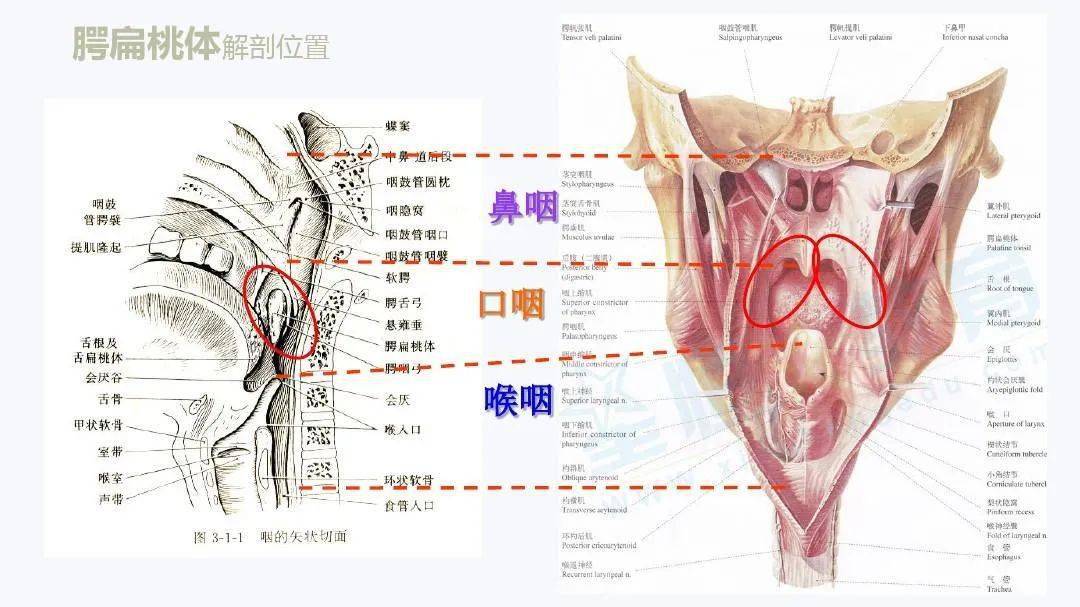 扁桃体周围血管解剖图图片