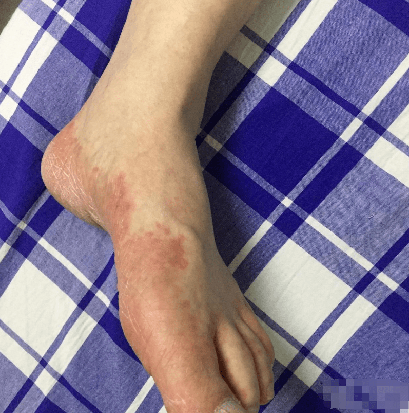 系统性红斑狼疮,类风湿性关节炎,干燥综合征,皮肌炎,混合性结缔组织病