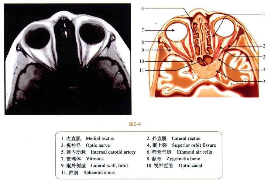速查图谱眼眶mri断层解剖