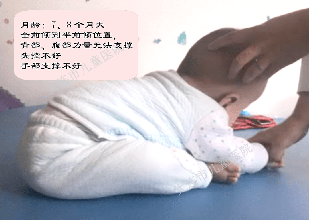 但两名宝宝仍然处于全前倾到半前倾的位置,背部,腹部,躯干力量无法