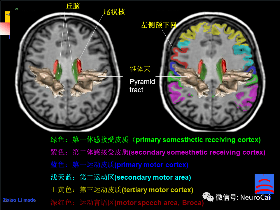 影像解剖 | 腦局部解剖與功能圖譜_頭皮