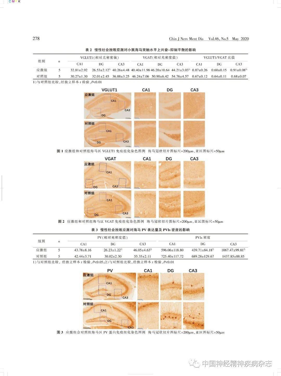 论著67慢性社会挫败应激对小鼠海马兴奋抑制平衡和认知功能的影响