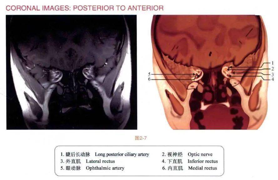 速查图谱眼眶mri断层解剖