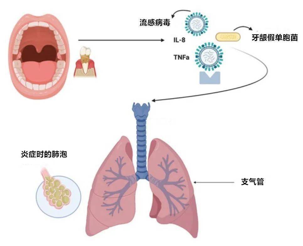 少儿呼吸道感染_儿童呼吸道感染症状吃什么药_儿童上呼吸道感染症状