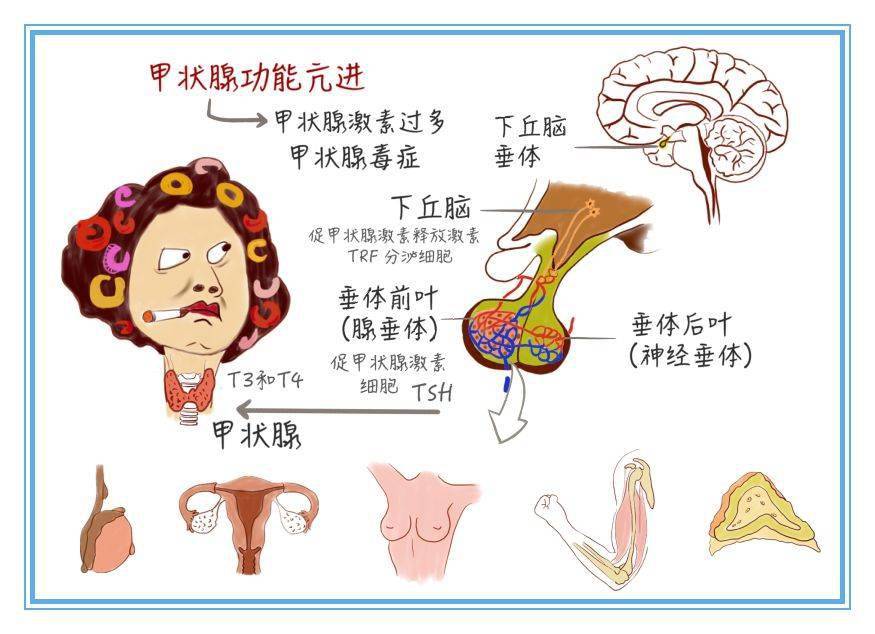 医学手绘包租婆突然变身大胃王竟还瘦出小蛮腰小心是甲亢