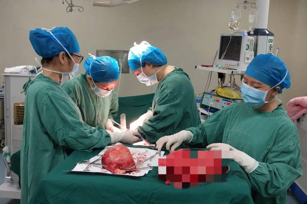 7月3日下午,手术开始产科主任廖建成与刘英姿,王爱容三位医生打开唐