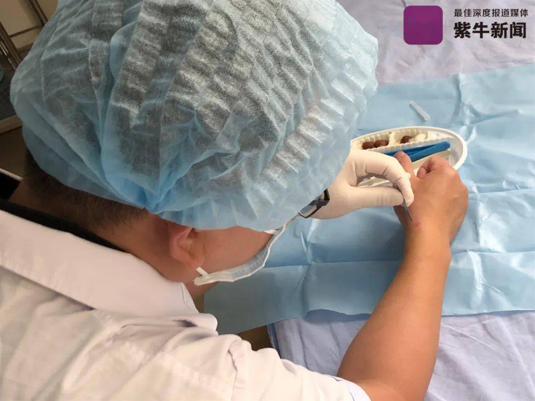 骨科医生用左手给自己右手做手术网友是个狠人
