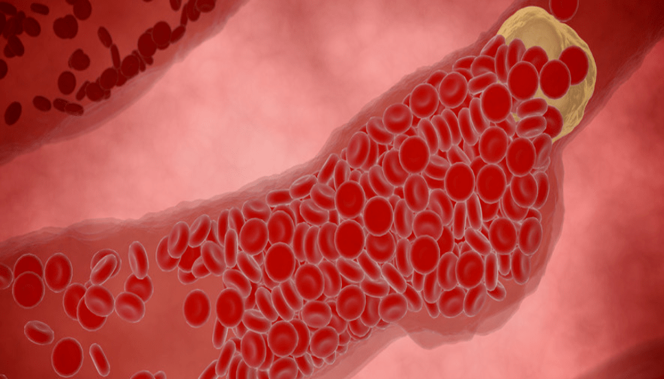 血管又不是下水道!_血液