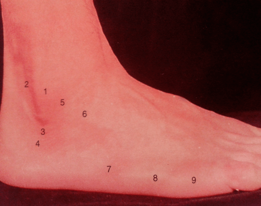 踝关节外侧解剖标志