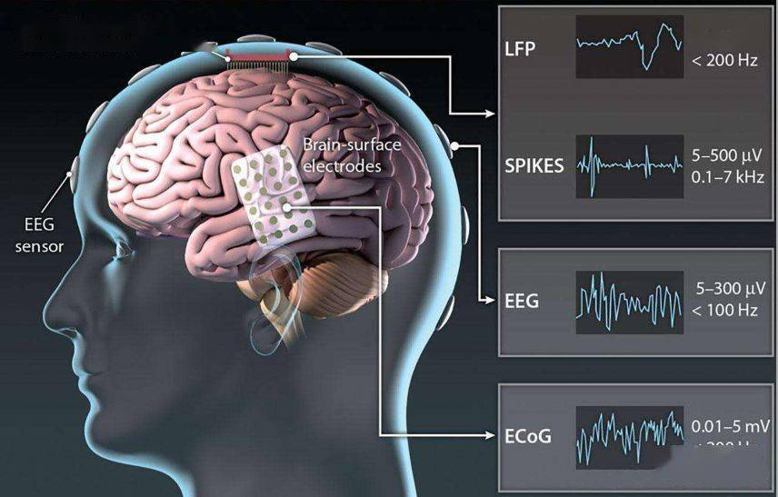深度解析脑机接口技术的现状与未来