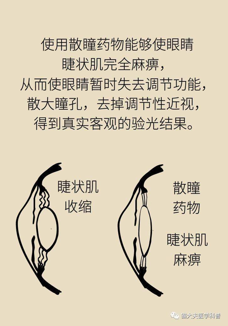医生为什么要给我的孩子散瞳验光