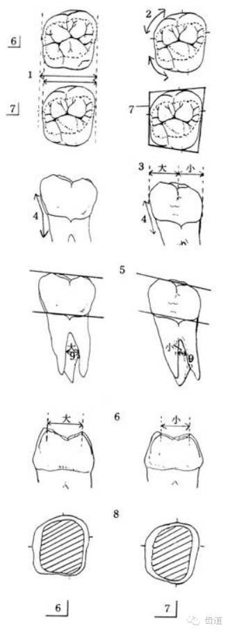 牙尖斜度图解图片