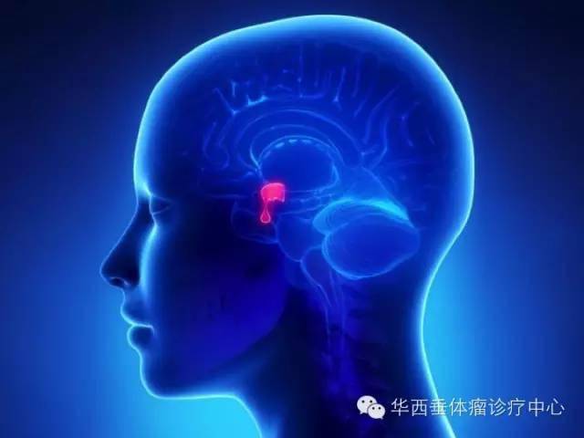 叛逆的细胞——垂体瘤的前世今生