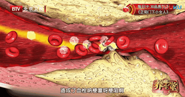 改善微循环!做好4件事,告别"淤"和"堵"
