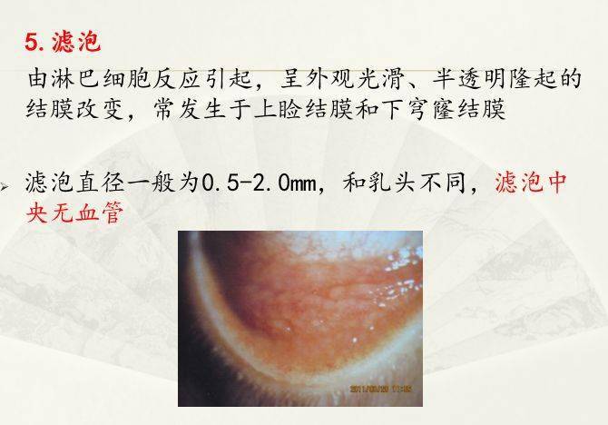 眼视光结膜病