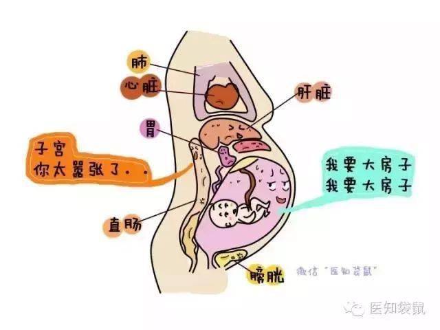 孕期便秘知多少