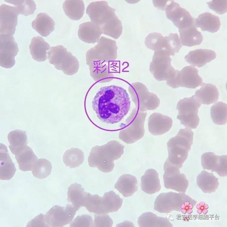 02形态特征:胞体大小均一,呈圆形或类圆形;胞质较少,呈透明的天蓝色