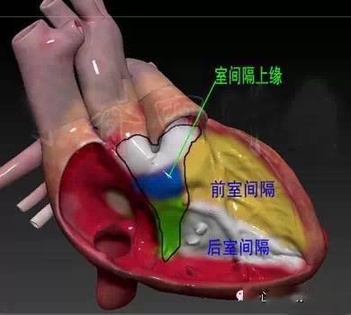 分法四:分室间隔上部,室间隔中部,室间隔下部,就是把上面两分法改为3