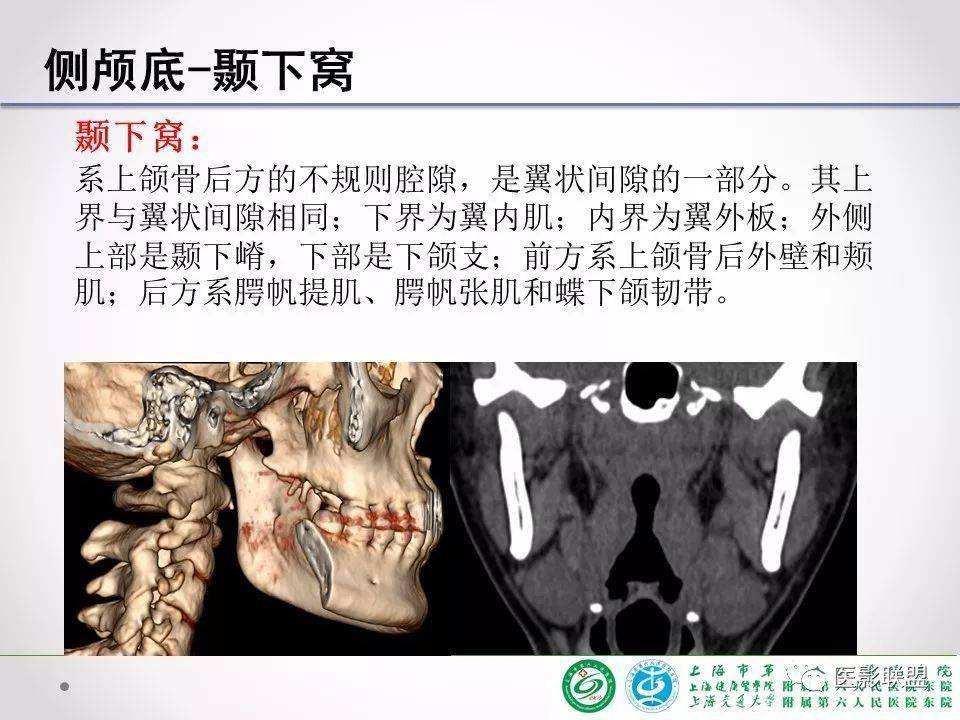 侧颅底临床解剖和影像