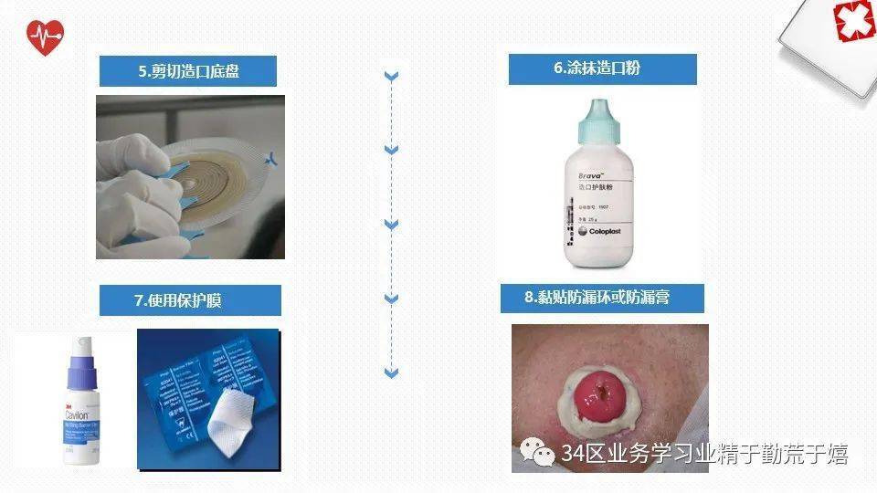 这样给造口患者的健康宣教事半功倍