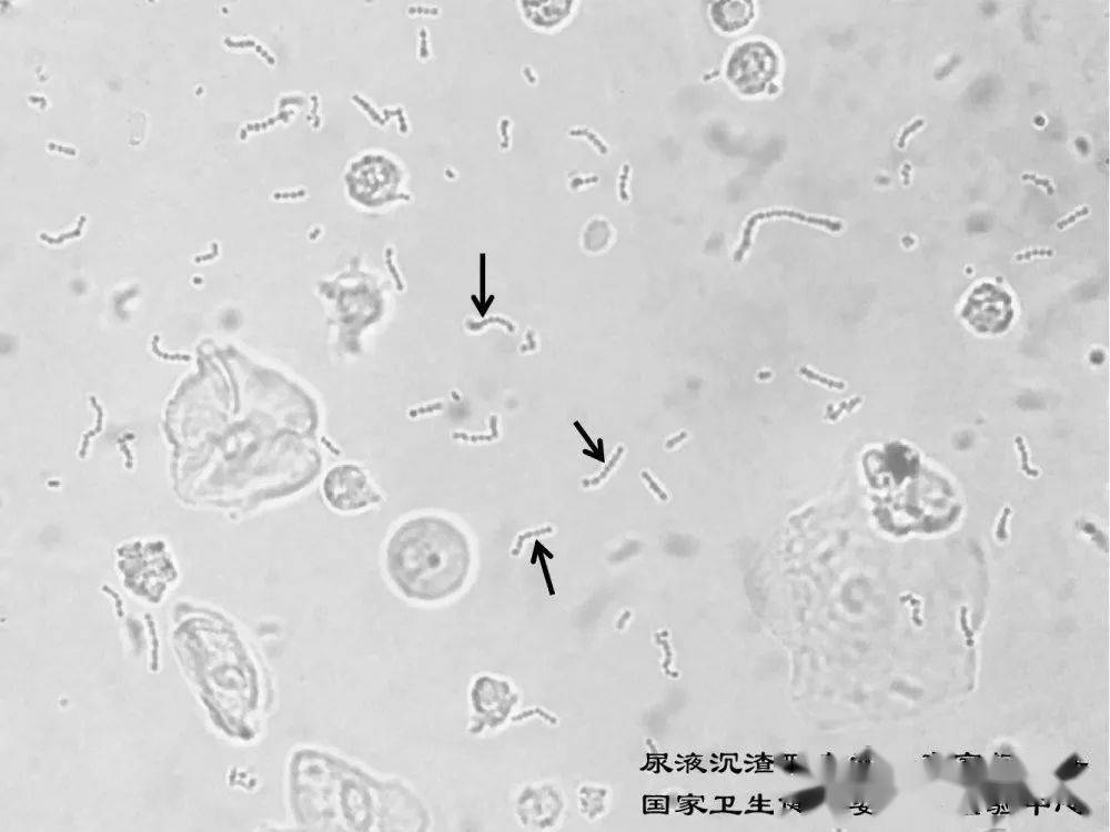 尿沉渣细菌图片