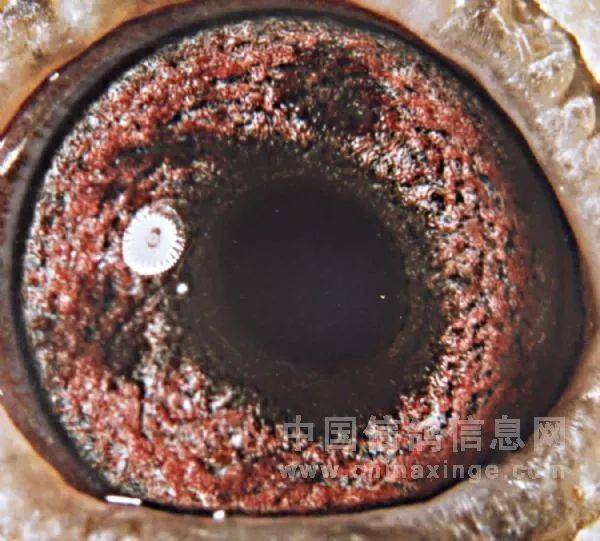 后天黑斑两种,先天黑斑是因鸽眼结构形成的透底的,与黑线口的原理相同